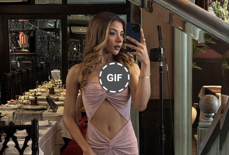 Zsa Zsa Utari Operasi Plastik Face Change Makin Percaya Diri