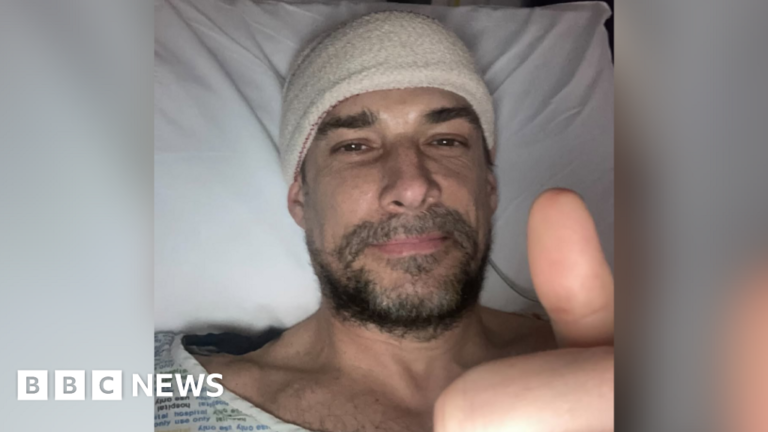 Protein film actor Craig Russell ‘lucky’ to see film after brain tumour