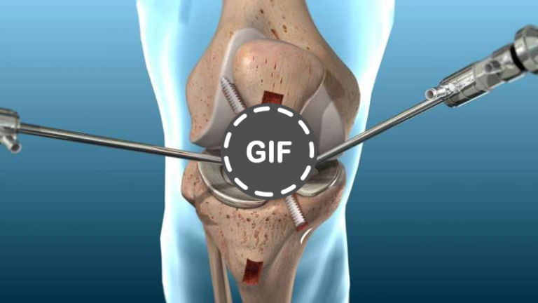 Panduan Lengkap Untuk Sendi Sehat » Dashofinsight Panduan Lengkap Untuk Sendi Sehat » Dashofinsight