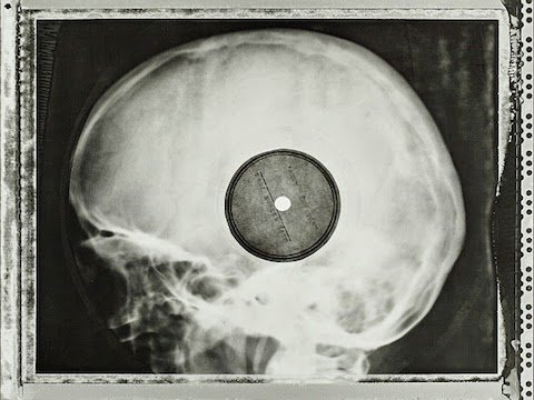 When Soviet Youth Bootlegged Western Rock Music on Discarded X-Rays: Hear Original Audio Samples When Soviet Youth Bootlegged Western Rock Music on Discarded X-Rays: Hear Original Audio Samples