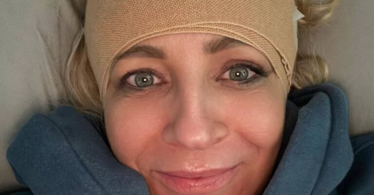 Carrie Bickmore to undergo surgery after ‘walking into a wall’ in horror injury